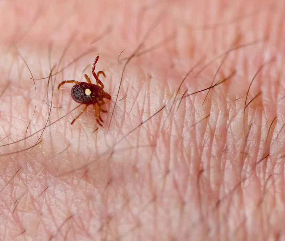 Image of American Lone Star Tick on skin.